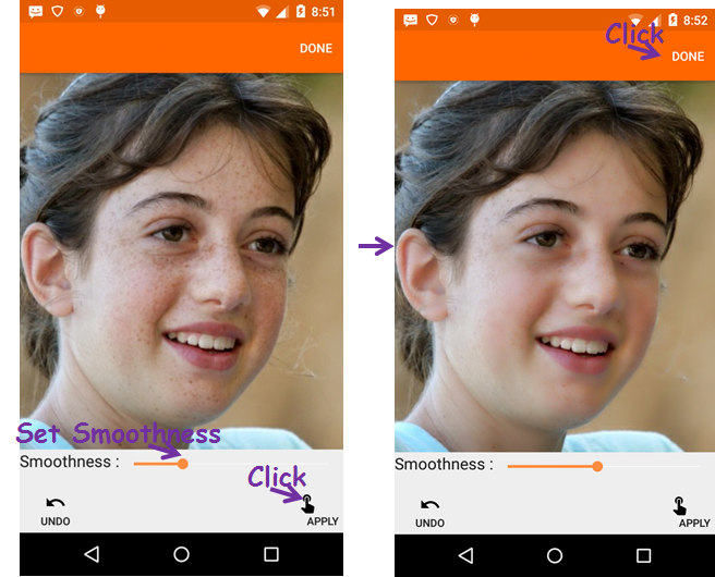 Face Acne Remover Photo Editor
