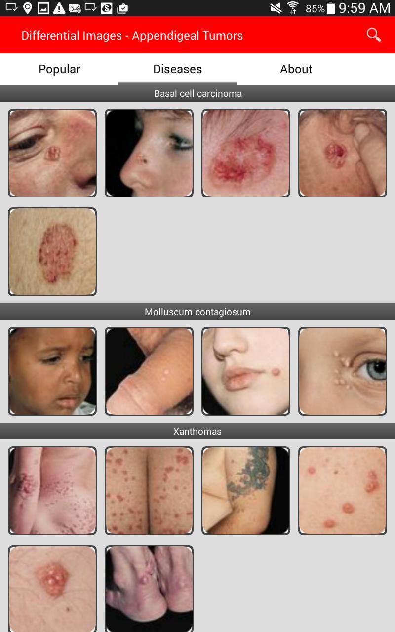 Derm101