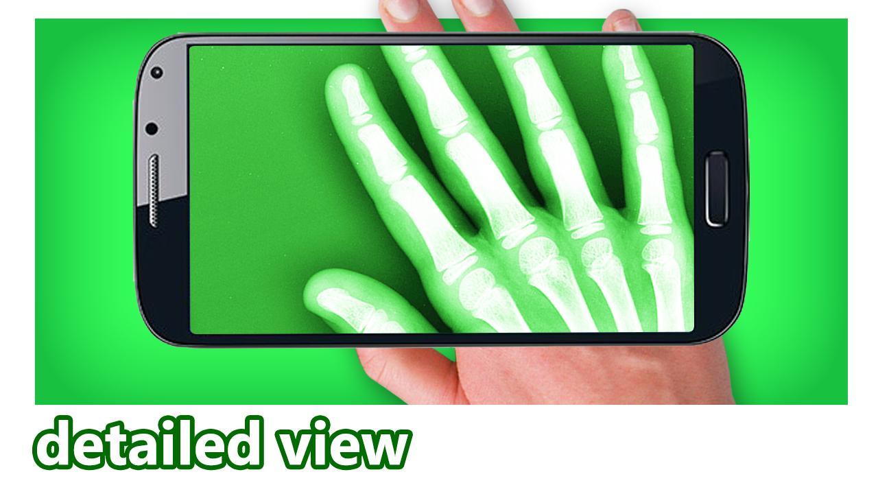 X-Ray Photo & Video Booth